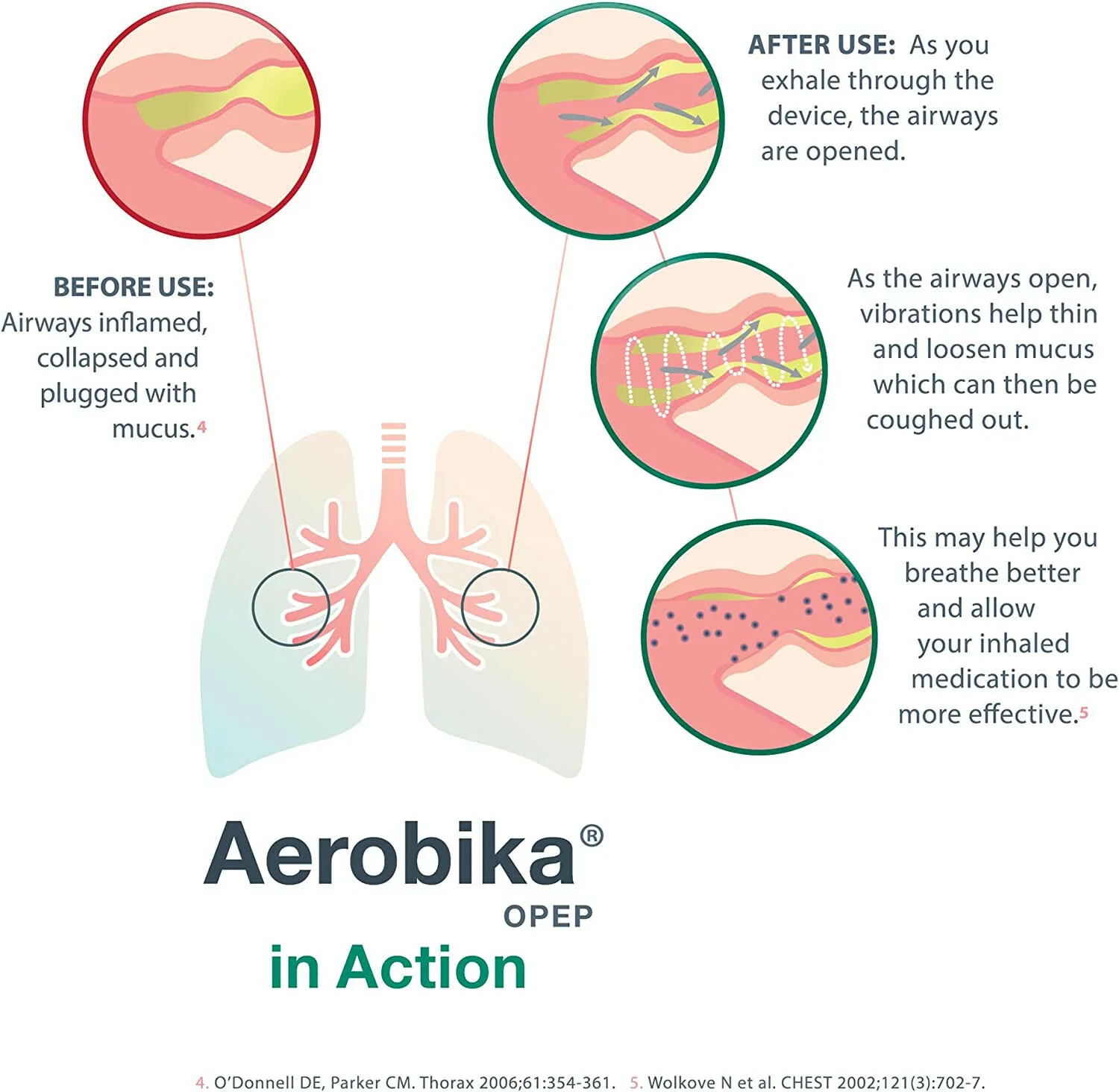 Oscillating Positive Expiratory Pressure (OPEP) Device by Aerobika® – Drug-Free Airway Clearance Therapy | 1 Device - Image 7
