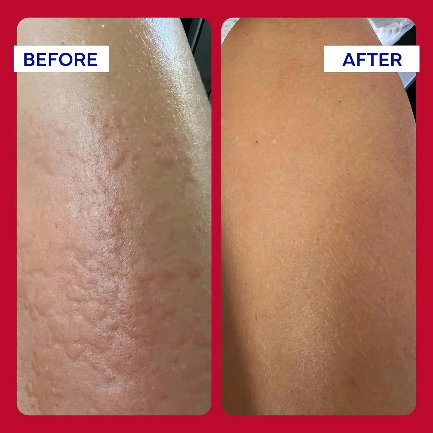 EMUAIDMAX Ointment for Itchy Skin | emuaid® | 59 mL - Image 9
